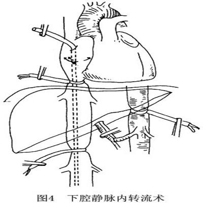 失血性貧血怎麼回事以及處理？