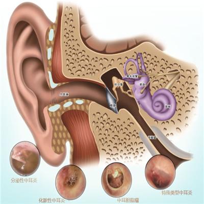 上耳根疼是怎麼回事