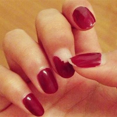 灰指甲的初期癥狀