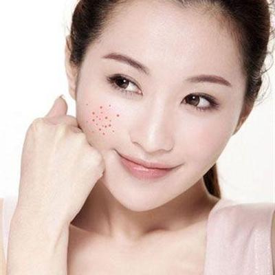 下巴長痘痘怎麼辦