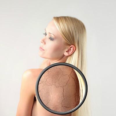 激光去痣後註意事項有納西