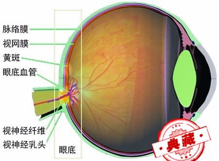 動脈硬化與高血壓有哪些眼部病變表現