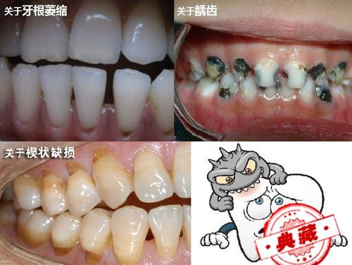 掌握正確的刷牙方法-圖解巴氏Bass刷牙法