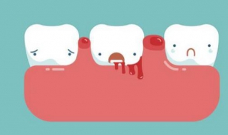 牙齦出血是什麼原因 導致牙齦出血的原因
