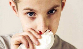 鼻咽癌早期癥狀表現 五個方面