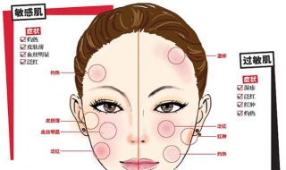 臉上過敏怎麼辦 6招改變過敏情況