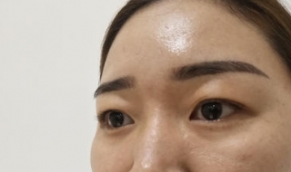 下眼皮松弛怎麼辦 兩種簡單方法分享