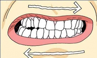 磨牙怎麼辦 具體內容具體分析