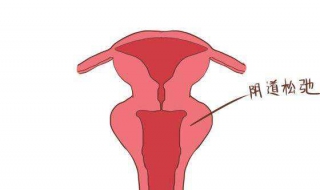 產後陰道松弛怎麼辦 6個 產後陰道恢復的方法