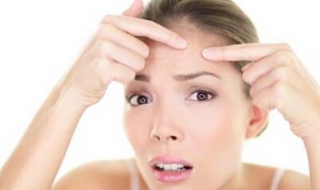 額頭上長痤瘡怎麼辦 怎麼護理肌膚不長痔瘡