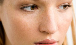 滿臉色斑怎麼辦 這些方法可以消除色斑