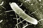 陰溝腸桿菌感染
