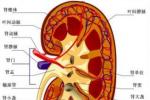 狼瘡腎炎