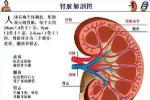 狼瘡腎炎