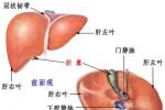 肝瘟