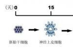 亨廷頓病性癡呆