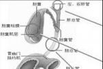 前列腺鈣化