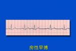 老年人房性早搏