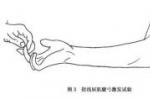 旋後圓肌綜合癥