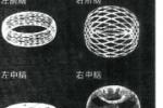 抽動癥
