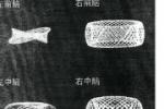 抽動癥