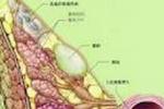 生乳頭汗管囊腺瘤