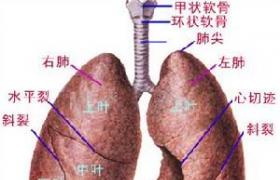 先天性支氣管肺囊腫