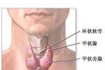 老年人甲狀腺癌