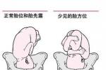 胎位異常