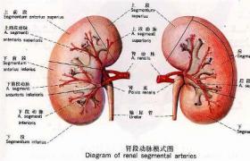 小兒腎積水