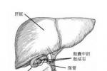 小兒急性膽囊炎