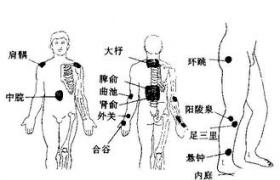 小兒周期性低血鉀性麻痹