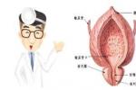 特異性前列腺炎