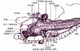 急性胰腺炎