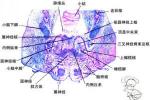 腦橋中央髓鞘溶解癥