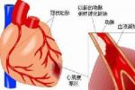 心室顫動