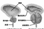 前列腺異位