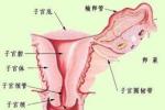 宮頸外翻