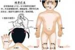 抽搐與驚厥