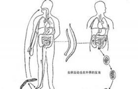 鉤蟲病