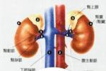 腎炎