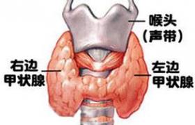 甲狀腺腺瘤