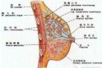 急性乳腺炎