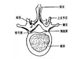 椎管狹窄