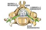 椎管狹窄