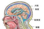外傷性腦脊液漏