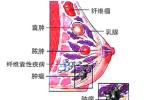 乳頭溢液