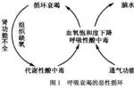 小兒急性呼吸衰竭