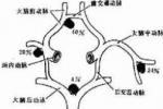 動脈瘤