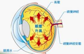 絲狀角膜炎